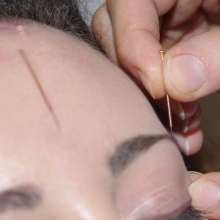 Ingrandire l'immagine: Rita Mantovani, anestesista Varese