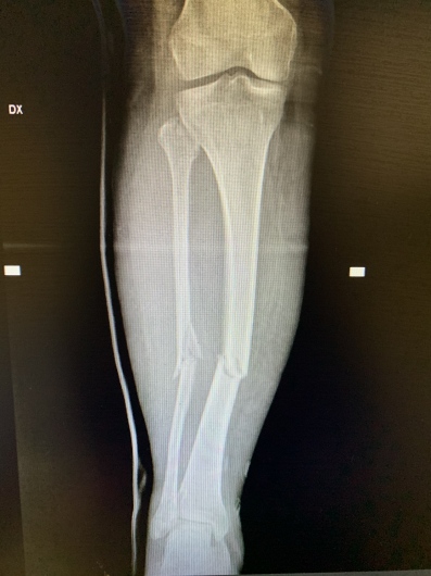 Francesco Tancredi-16