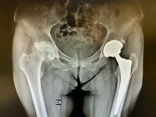 Francesco Tancredi-12