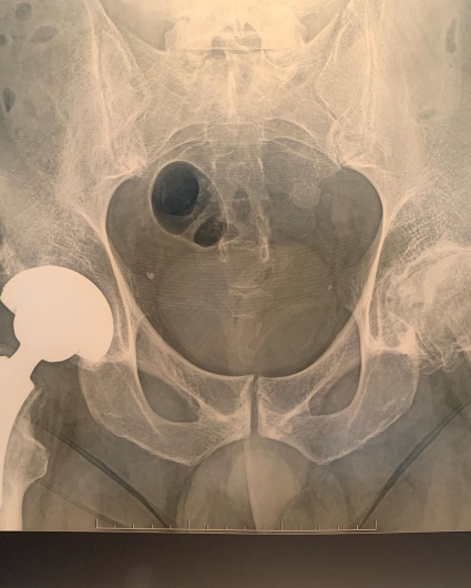 Francesco Tancredi-19