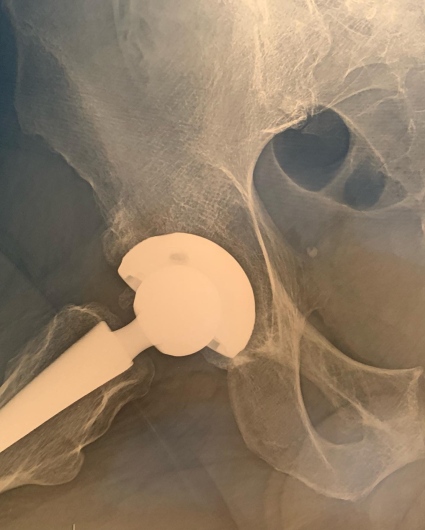 Francesco Tancredi-20