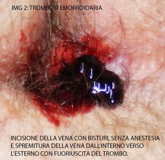 Gaspare Biundo-10