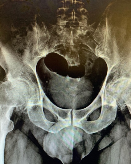 Francesco Tancredi-18