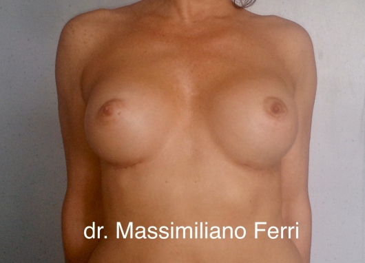 Massimiliano Ferri-0