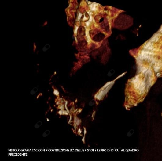 Gaspare Biundo-5