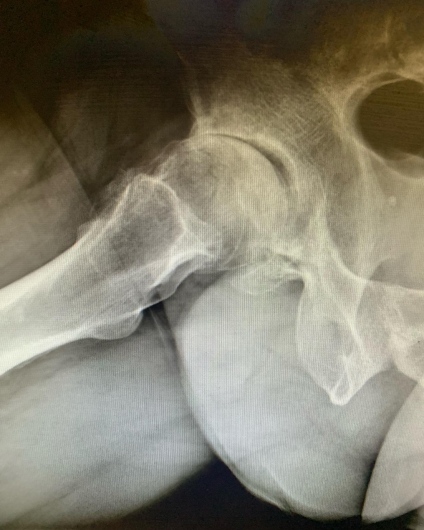 Francesco Tancredi-21