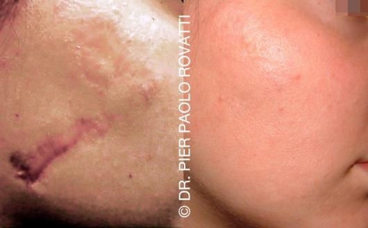 Margherita Fadda Blattner-5