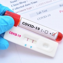 Ingrandire l'immagine: Screening Covid-19 Sanitas Friuli, Covid Test Gemona del Friuli