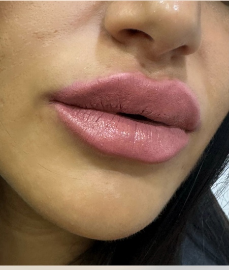 Rosa Caduto-6