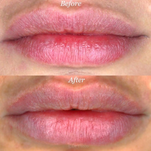 Piergiorgio Turco-26