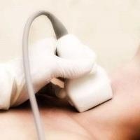 Ingrandire l'immagine: Gabriella Manzoni, Radiologo Olbia