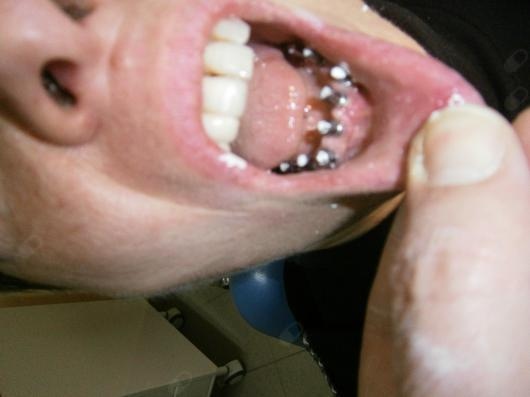 Bruno Renato Salerno-2