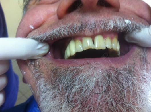 Bruno Renato Salerno-7