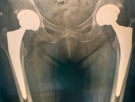 Francesco Tancredi-13