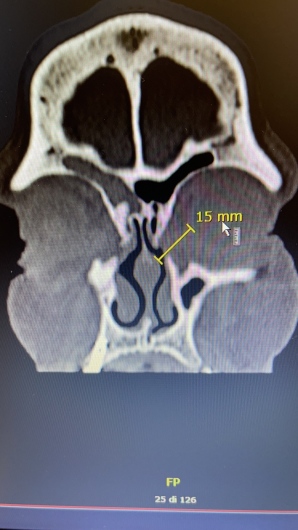Giorgio Oliviero Gallone-16