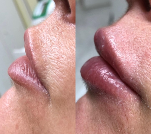 Carolina Caliendo-11