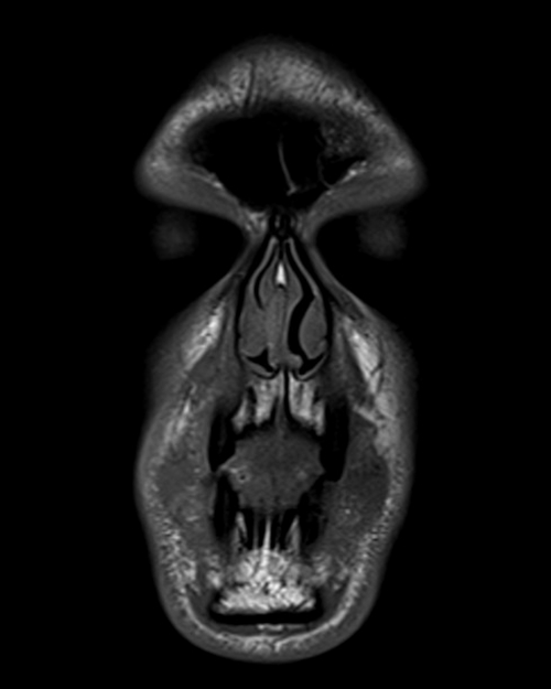 MRI face T1 axial images 