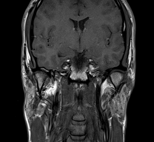 MRI face T1 axial images