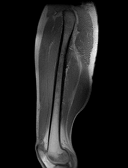 mri thigh localizer image