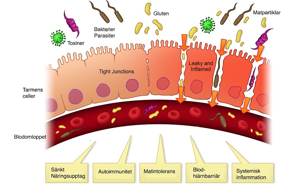 candida symptom tarm