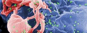 Hiv