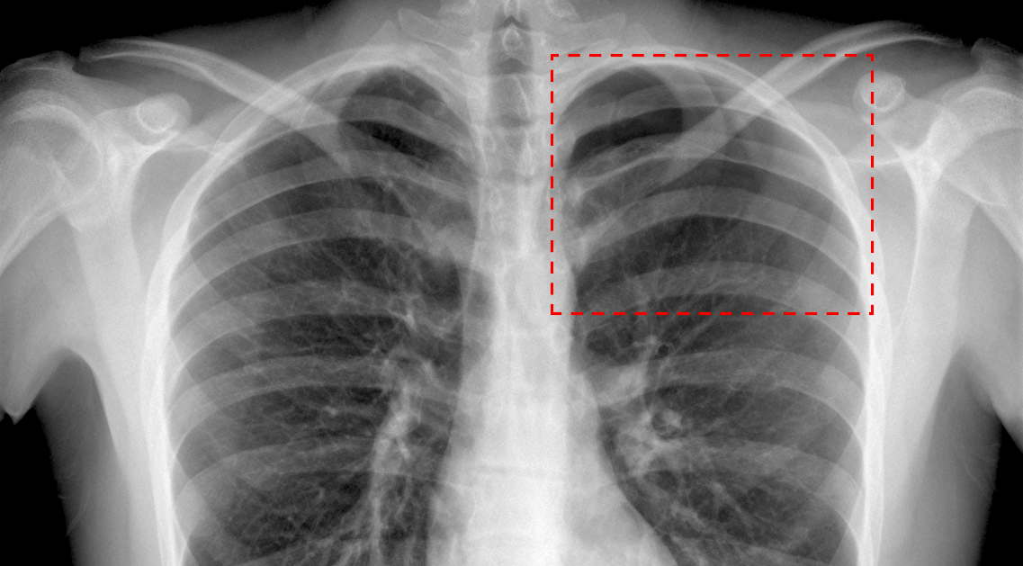 Santé : En Nouvelle-Calédonie, l’intelligence artificielle au service de la radiologie