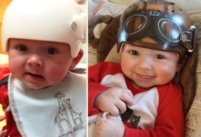 Baby Helm Voor En Na
