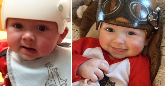 Baby Helm Voor En Na