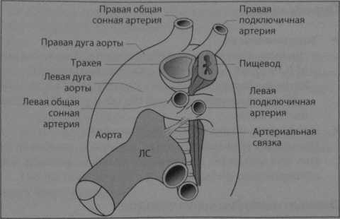 Снимки МРТ и КТ. Аномалии дуги аорты