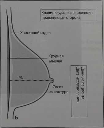 Снимки МРТ и КТ. Критерии качества PGMI