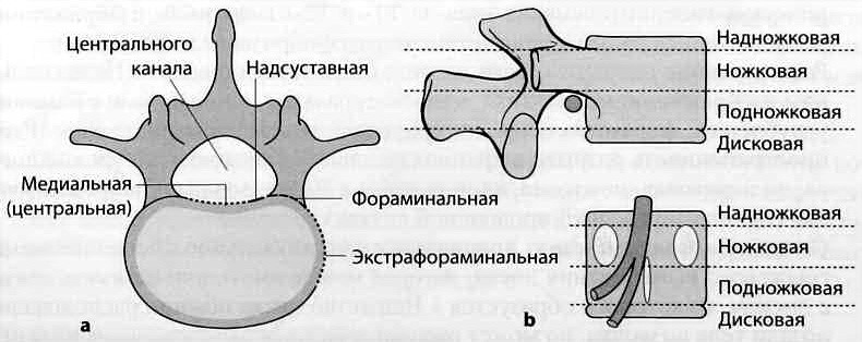 Снимки МРТ и КТ. Грыжа межпозвонкового диска