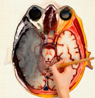 МРТ мозга с контрастом