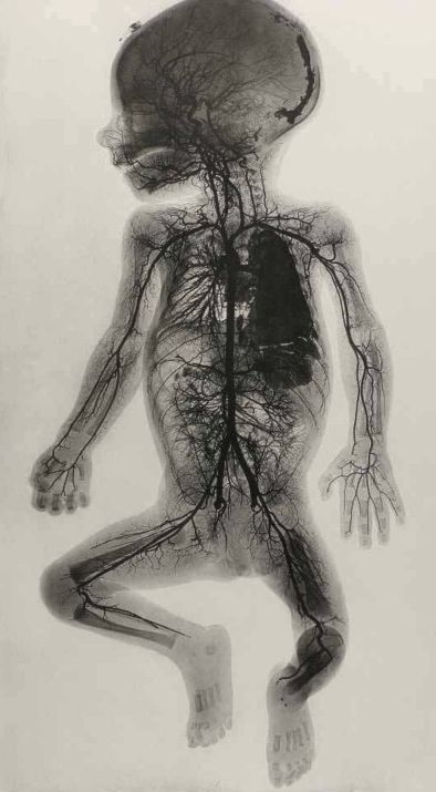 МРТ головы ребенку