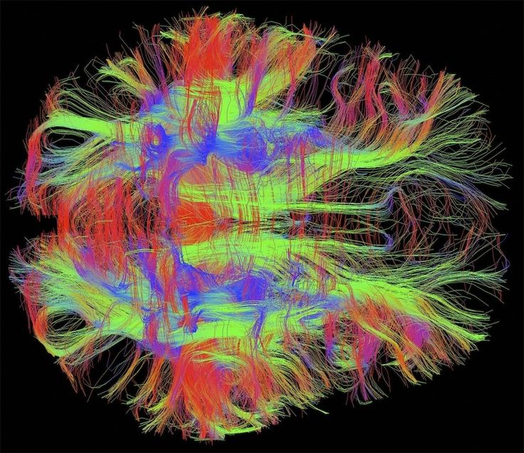 DTI трактография