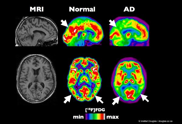 Томография головы, МРТ или КТ головного мозга