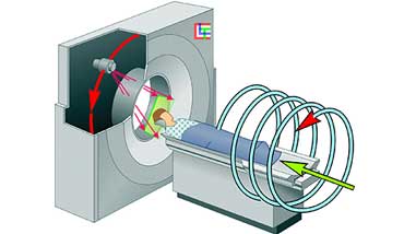 МСКТ, мультиспиральная компьютерная томография