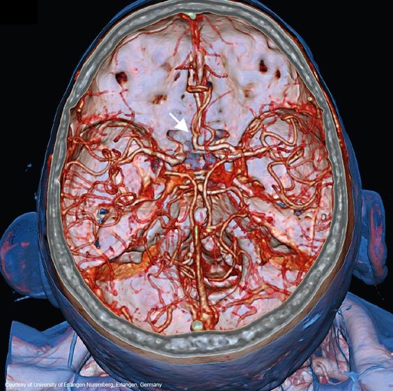 КТ с контрастированием