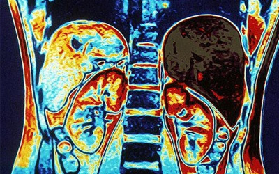 МРТ с контрастом