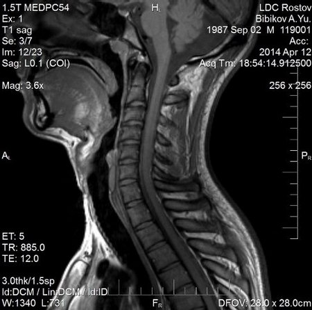 МРТ шеи, что показывает, где сделать в Москве и СПб