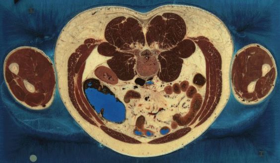 МРТ брюшной полости