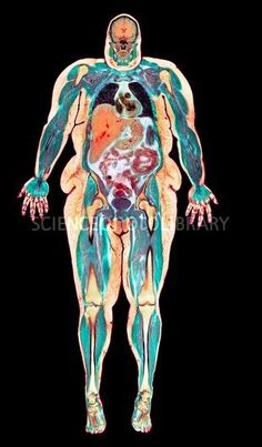 МРТ мягких тканей тела