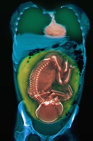 МРТ беременным