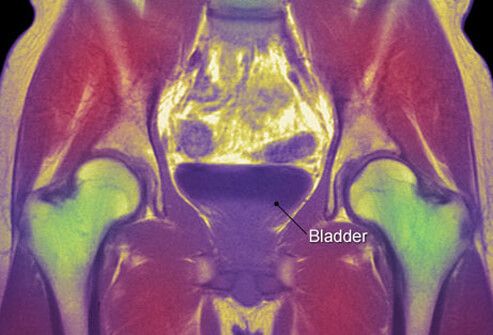 МРТ мочевого пузыря