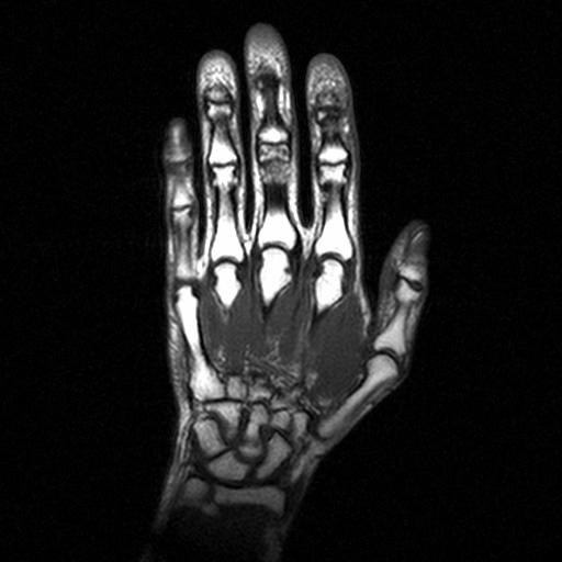 МРТ снимок кисти руки