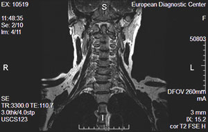 222 3 ΠΌΡΡ ΠΌΡΠ³ΠΊΠΈΡ
ΡΠΊΠ°Π½Π΅ΠΉ ΡΠ΅ΠΈ ΡΡΠΎ Π²ΠΊΠ»ΡΡΠ°Π΅Ρ Π² ΡΠ΅Π±Ρ