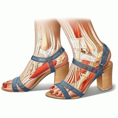 Строение стопы, МРТ диагностика