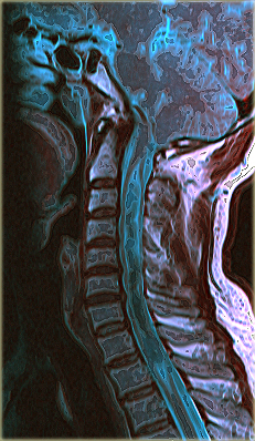 Томография органов и мягких тканей шеи, МРТ или КТ