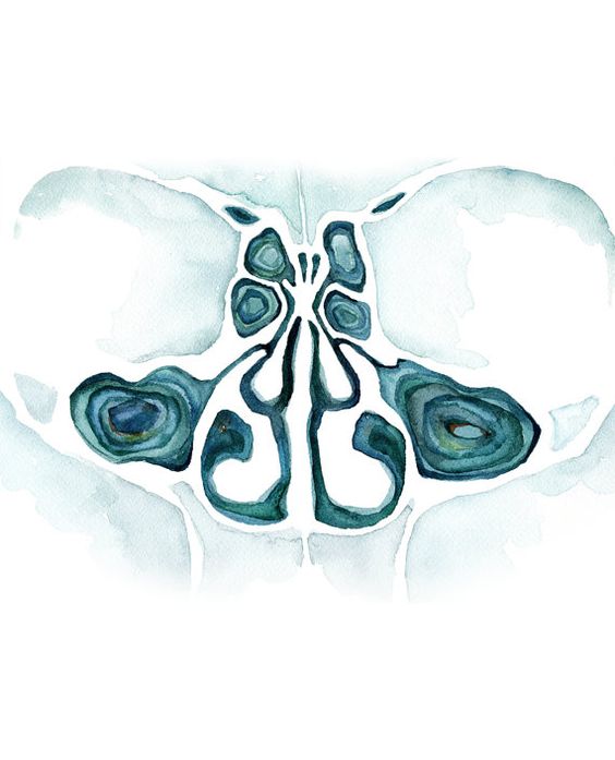 МРТ околоносовых пазух