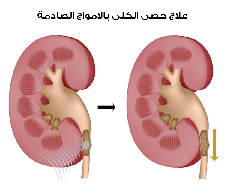 التكنلوجيا by shaimaa shbib - Illustrated by shaimaa shbib - Ourboox.com