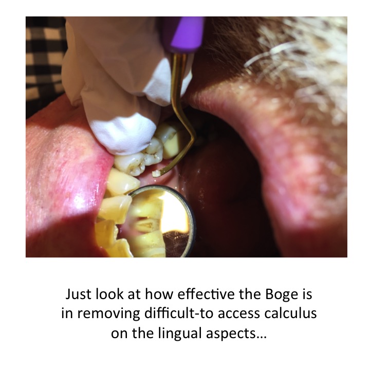 The Boge 513 Hoe Scaler by Stephen Pohlmann - Illustrated by Amin Qazizada - Ourboox.com